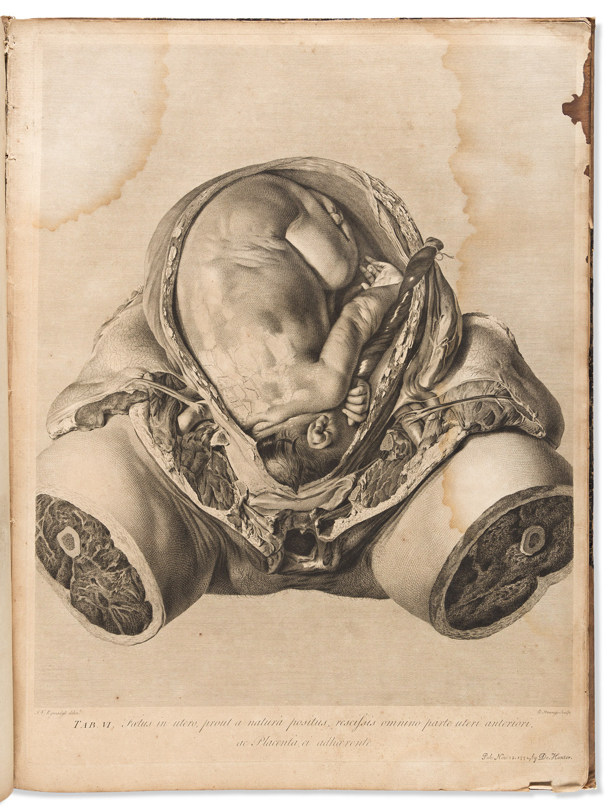 Hunter, William (1718-1783) Anatomia Uteri Humani Gravidi.